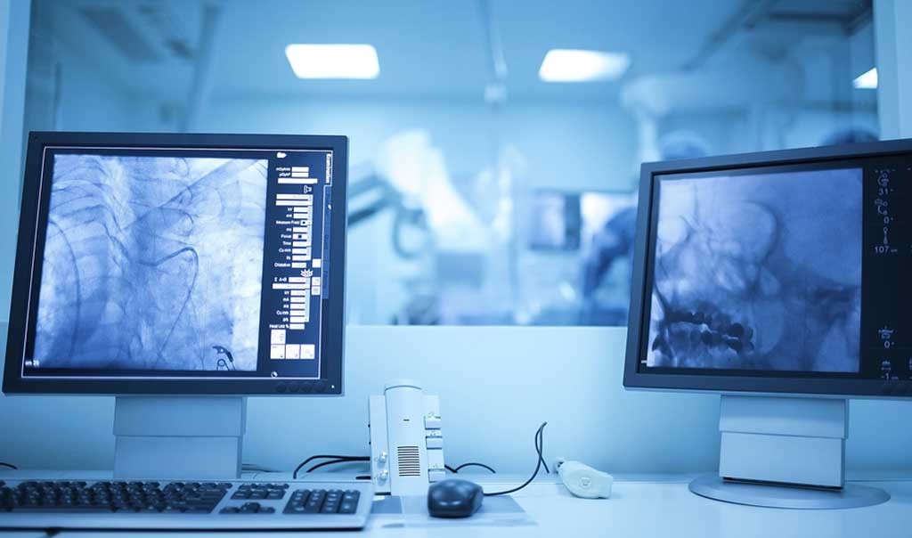 Understanding the Technical Superiority of the G101UAN01.0 LCD Display